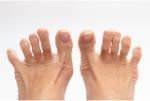 足指のパー
